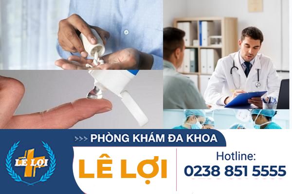 Chua-noi-mun-mu-o-vung-kin-nam